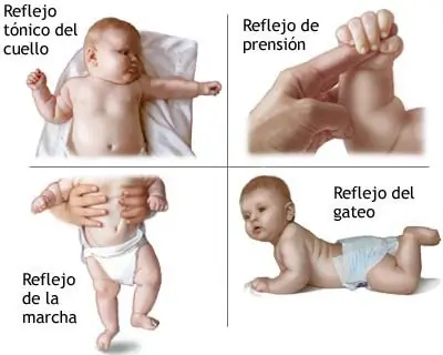 bebes