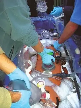 criogenizacion criogenizacion