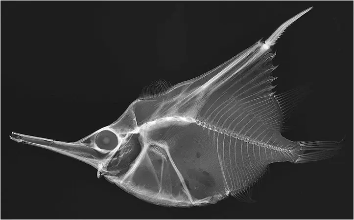 Es real  Con esto Se puede ver tras la Ropa X-ray