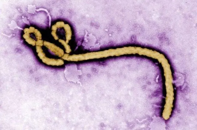 Ébola, el virus más temido