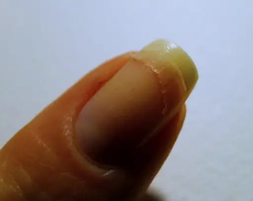 problemas de uñas largas con lincesas