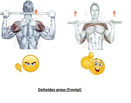 hipertrofia