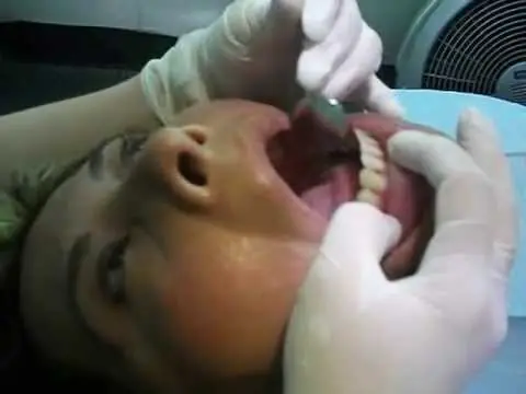 blanquear dientes en casa rapido