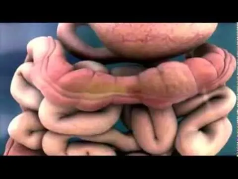 blanquear dientes casero