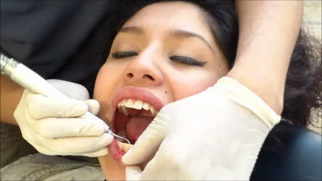 Blanquear dientes en casa