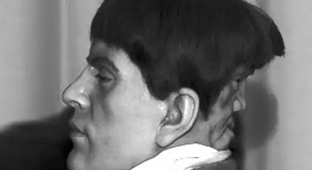 Edward Mordrake