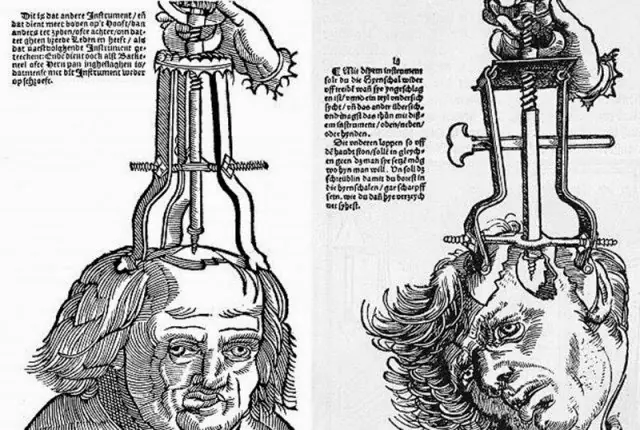 Procedimientos médicos que se creían curativos en el pasado Procedimientos médicos que se creían curativos en el pasado