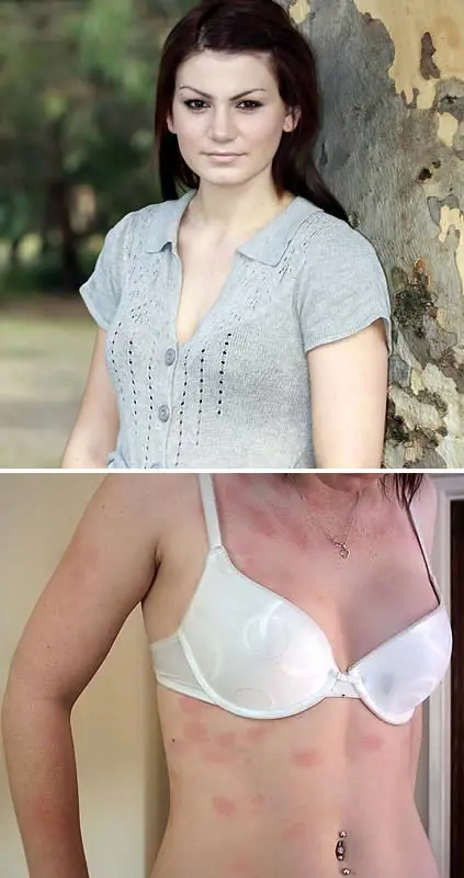 10 Personas Con Los Casos Médicos Màs Increíbles Del Mundo