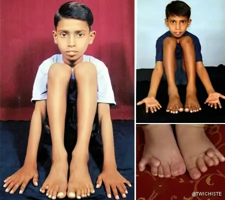 Las extremidades del cuerpo más grandes o raras.