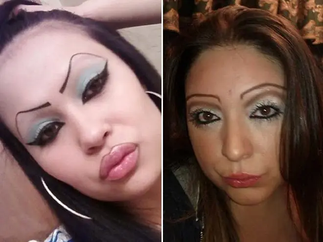 labios