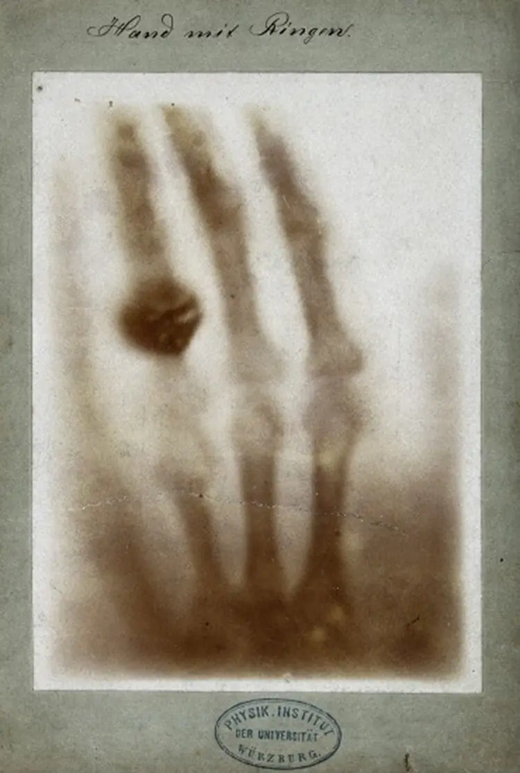 radiografia