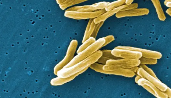 La tuberculosis multirresistente sigue asolando la región eu