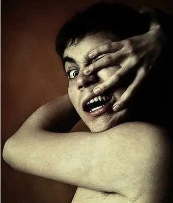 sindrome de la mano extrana sindrome de la mano extrana