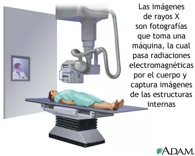 rayos x