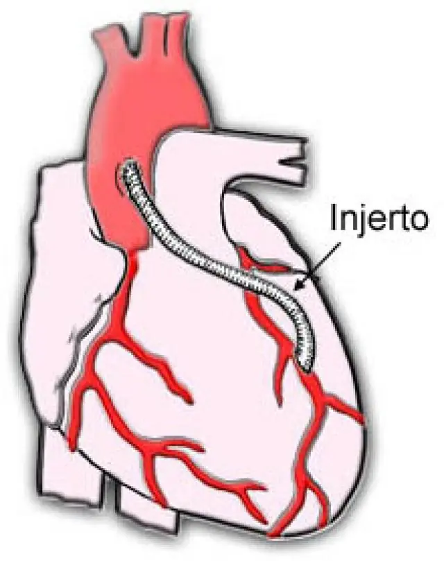 Los mejores inventos hechos por latinos (megapost) parte 1