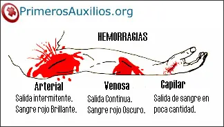 Formas de parar una hemorragia mas segura (Entra y aprende)