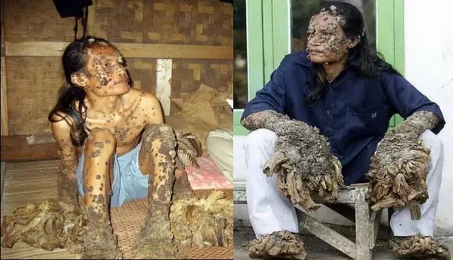 Las 10 mutaciones más raras y escalofriantes