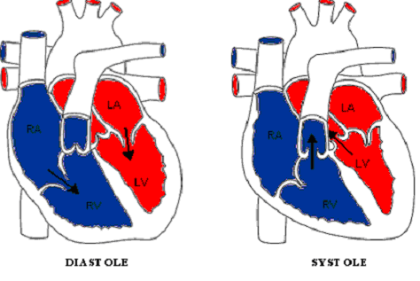 hipertension arterial sistemica