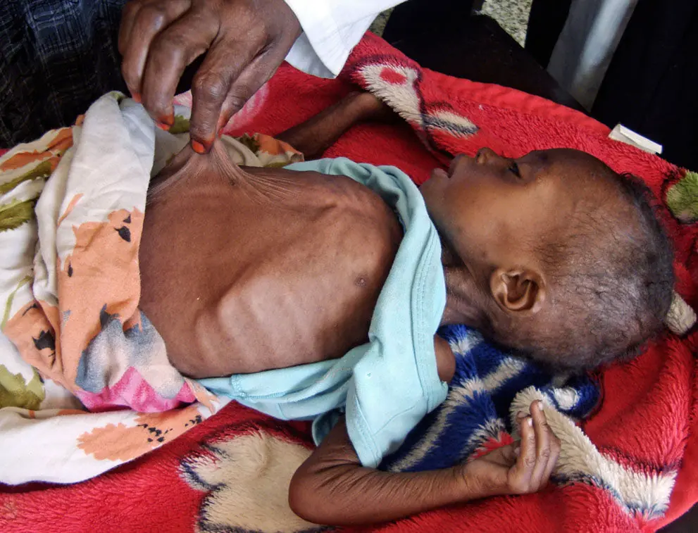 Los invisibles. Parte 1: Somalia. Los invisibles. Parte 1: Somalia.