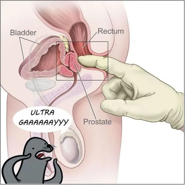 eslogan