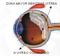 enfermedades