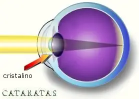 Ojos