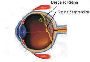 Ojos