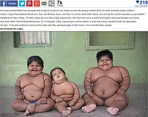 Parece Goringa: niños obesos