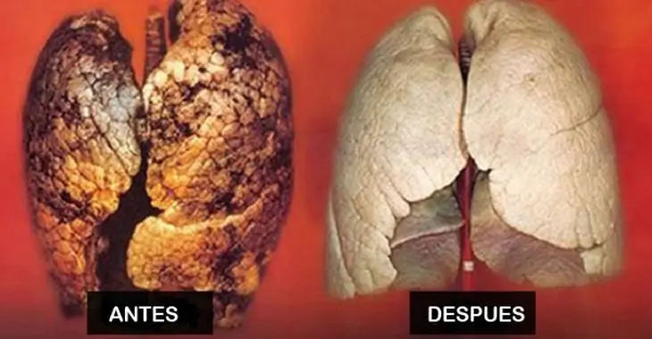respirar