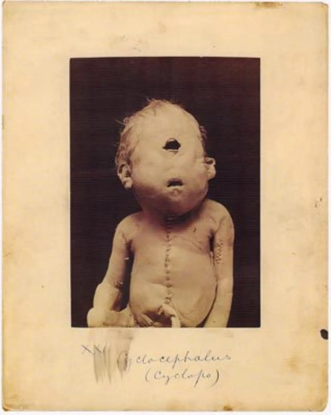 10 Fotografías antiguas y perturbadoras de problemas médicos