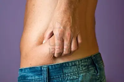 obesidad