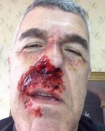 Si ya se soy muy fan de dady Brieva