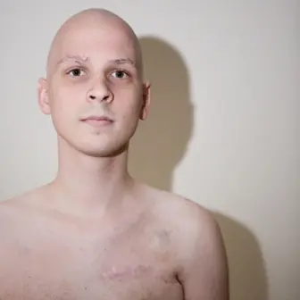 Bart Verbeeck Suicidio - Eutanasia