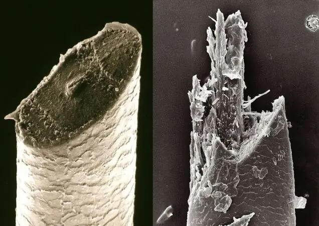 Cosas vistas bajo el microscopio