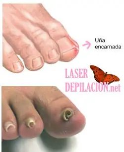operacion