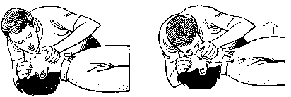 Todo lo que debes saber sobre el RCP[Resucitacion Cardio ]
