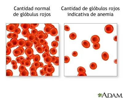 informacion
