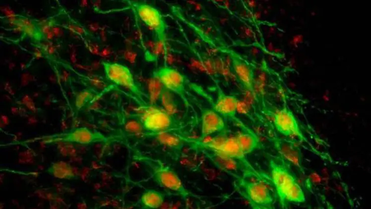 Las 10 sorprendentes maneras de manipular el cerebro humano