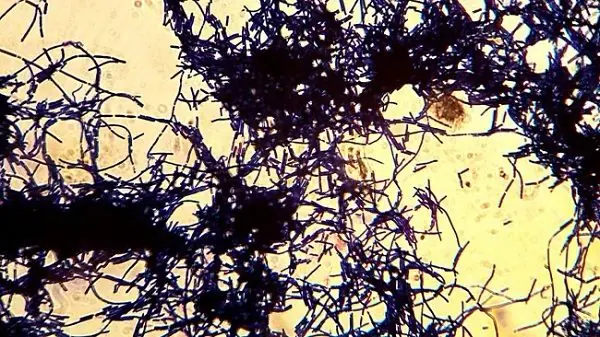 Bioconcreto, el material que se regenera a si mismo