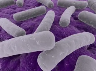 amebiasis