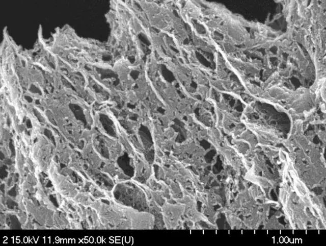 supercondensadores