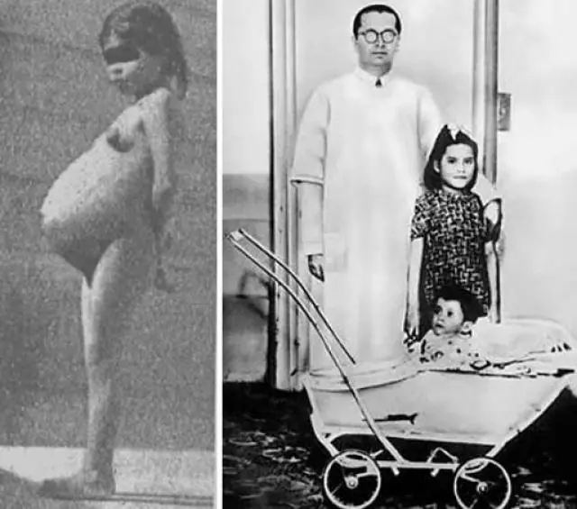 Los 10 Casos De Gestación Más Sorprendentes