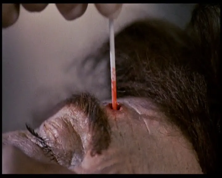 Re animator