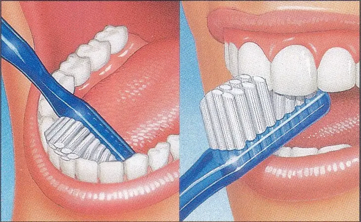 lavado de dientes