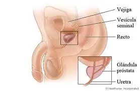 Prevención del cáncer de próstata