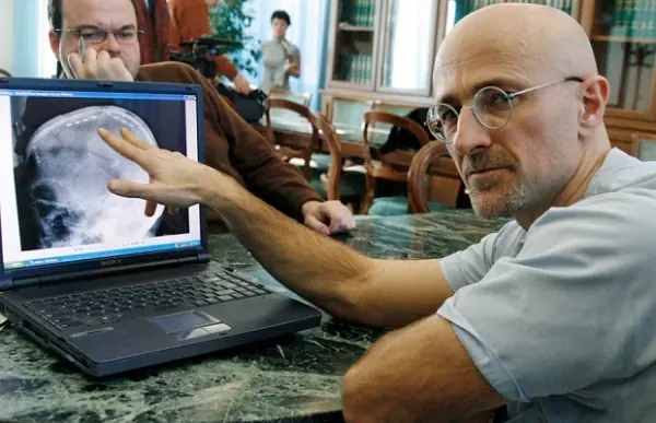 sergio canavero
