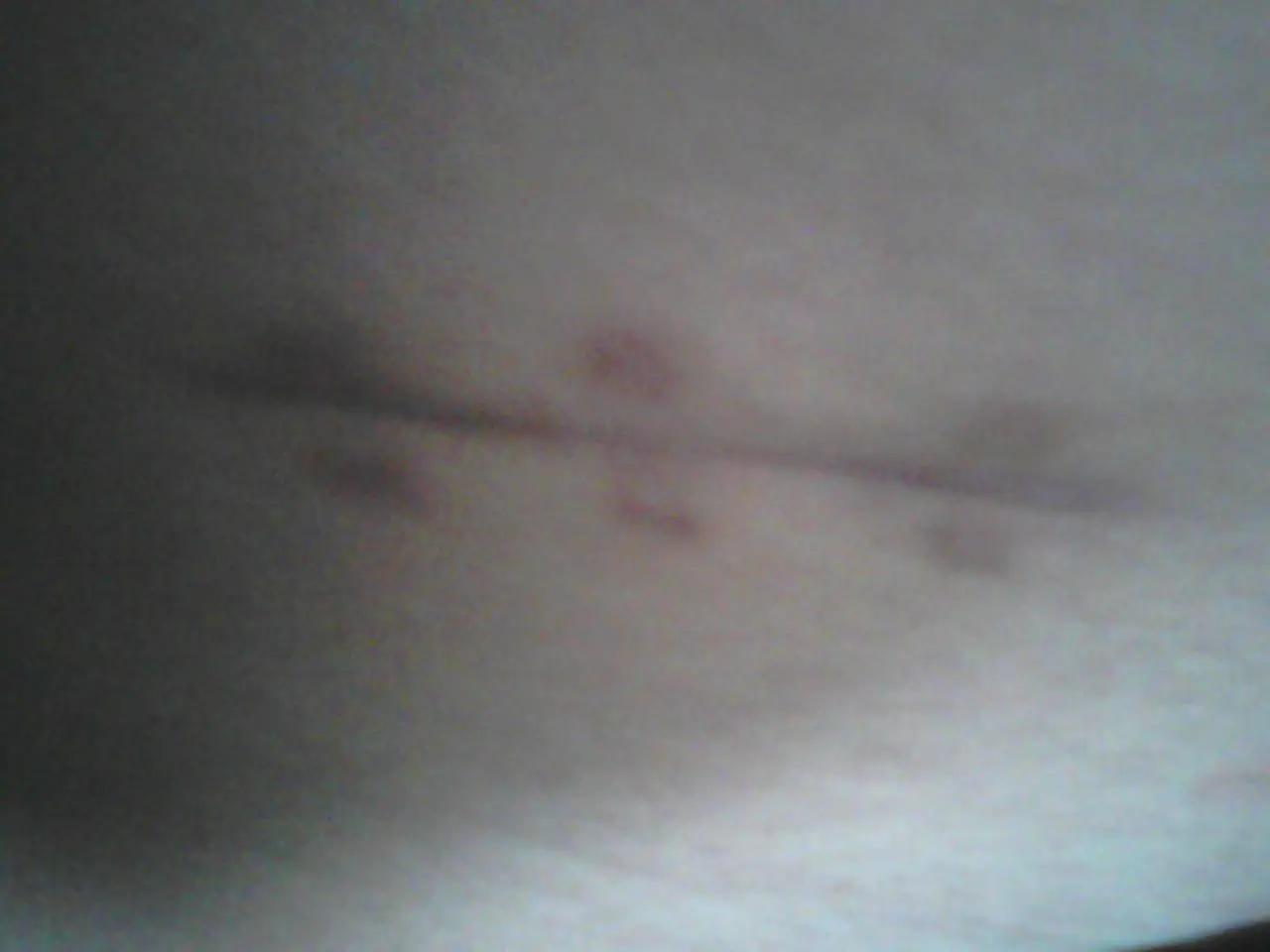sufrimiento