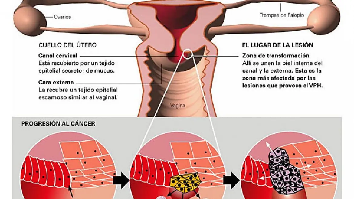 Confirman que el sexo oral provoca cáncer bucal