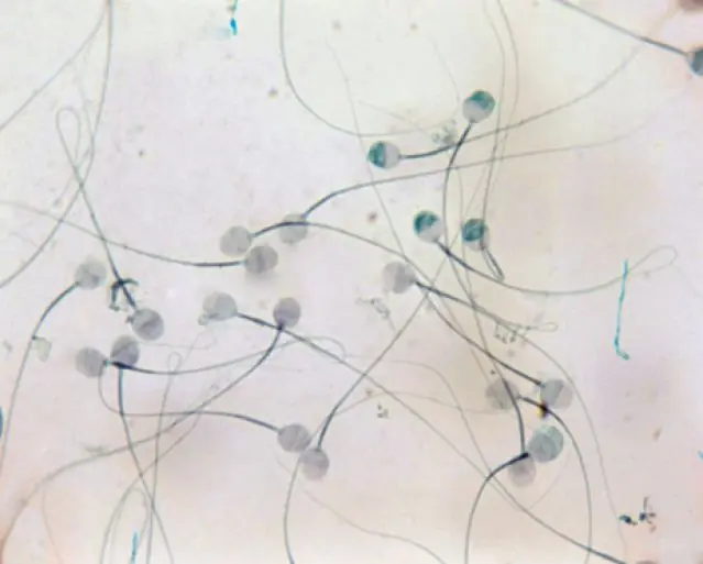 Curiosidades sobre el semen