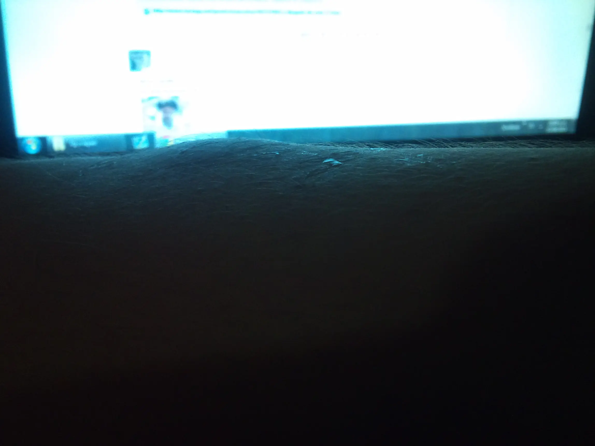 Golpes en la japierna